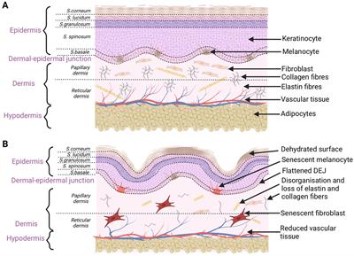 Skin senescence—from basic research to clinical practice